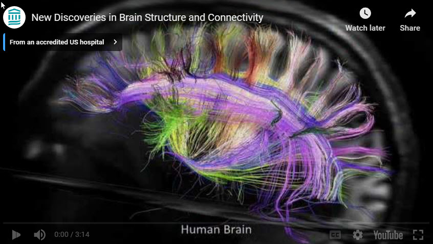 Axon Pathways in Human Brain