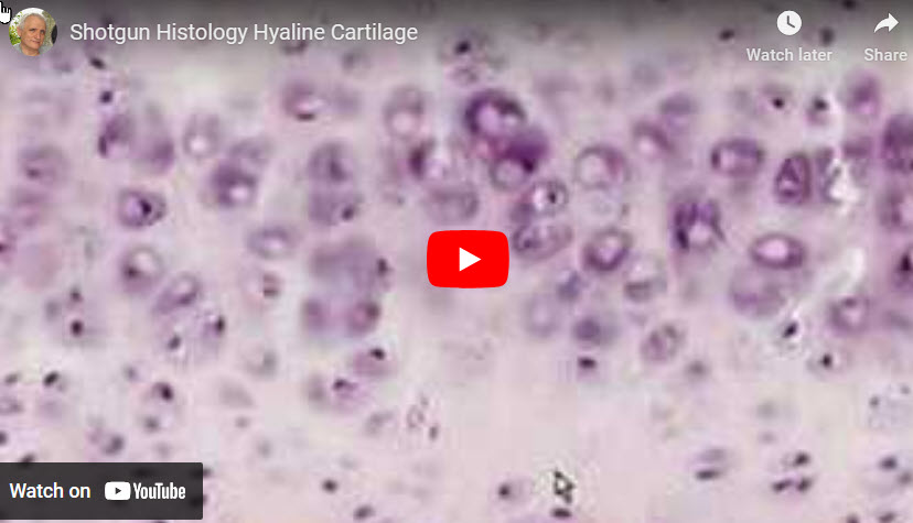 Pathologist's description of hyaline cartilage